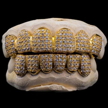 Custom Moissnaite Diamond Grillz In 14K Yellow Gold